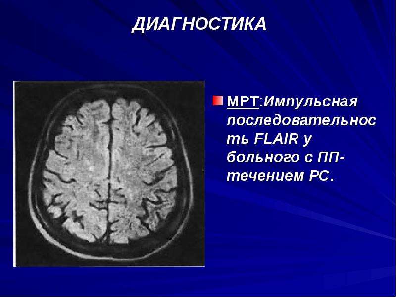 Презентация на тему рассеянный склероз