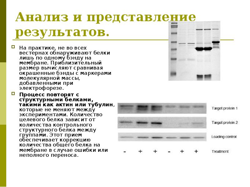 Анализ антинуклеарные антитела иммуноблот