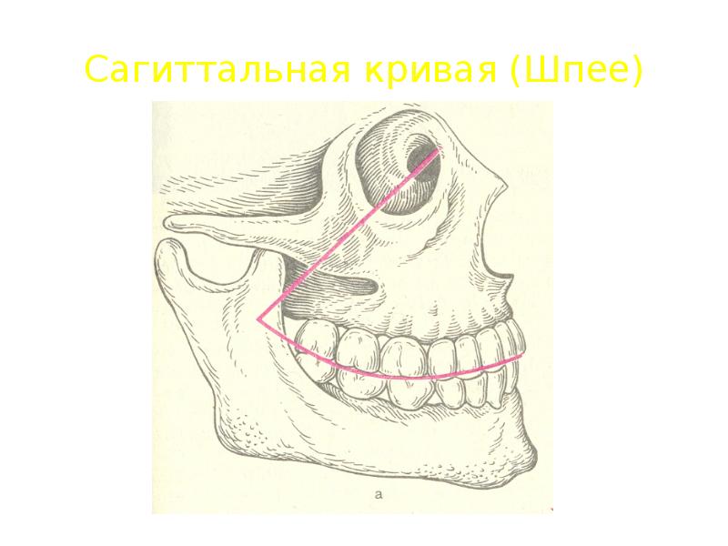 Сагиттальные аномалии. Сагиттальная Шпее и трансверзальная Уилсона. Кривая Шпее верхней челюсти. Сагиттальная окклюзионная кривая Шпее. Кривая Шпее и Вильсона.