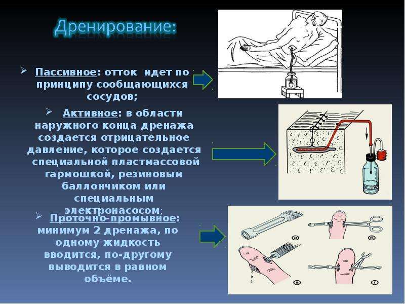 Дренаж ран. Дренирование антисептика. Методы дренирования в хирургии. Дренирование операционных РАН.