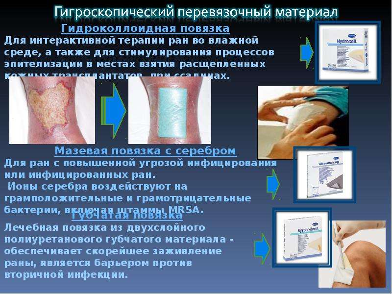 Современные перевязочные средства презентация