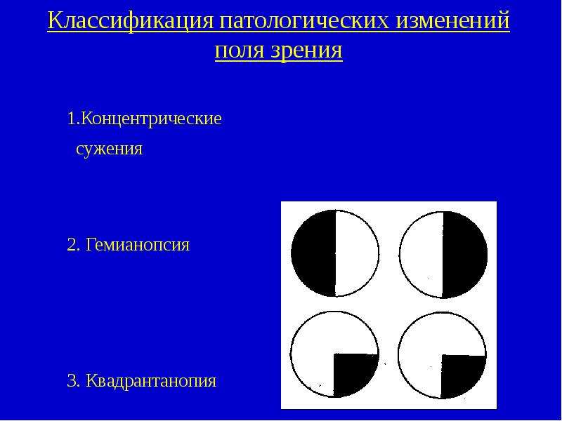 Сужение полей зрения. Сужение поля зрения неконцентрическое. Концентрическое сужение полей зрения. Патологические изменения поля зрения.