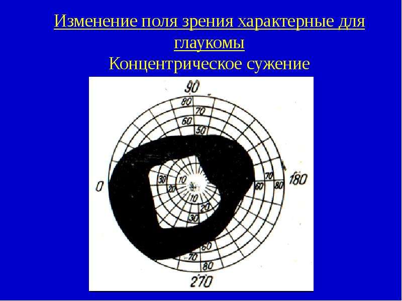 Как изменяется поле зрения. Концентрическое выпадение полей зрения. Изменение полей зрения. Концентрическое сужение полей зрения. Периметрия поля зрения.