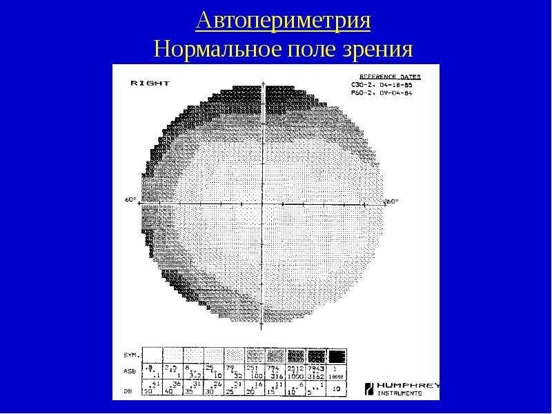 Нормальное поле. Статическая периметрия норма. Компьютерная периметрия глаза норма. Компьютерная периметрия поля зрения норма. Расшифровка компьютерной периметрии глаза.