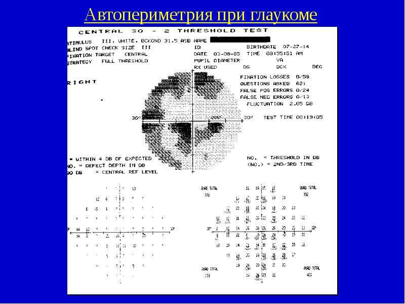 Периметрия расшифровка. Расшифровка компьютерной периметрии глаза норма. Компьютерная периметрия скотома. Периметрия Хамфри при глаукоме. Компьютерная периметрия Хамфри.