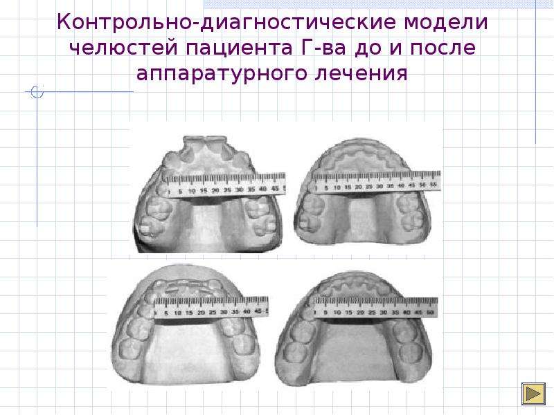 Контрольно диагностические