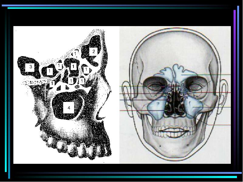 Пазухи черепа человека фото с описанием картинки