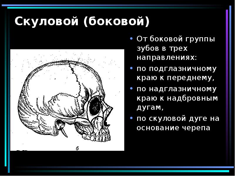 Переломы скуловой кости и дуги презентация