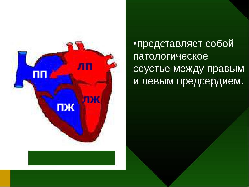 Между правым. Между правым левым и.