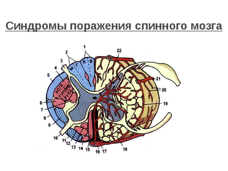 Синдром мозга. Синдром вентрального поражения спинного мозга. Концевой желудочек спинного мозга. Спайки спинного мозга. Поражение спинного мозга презентация.