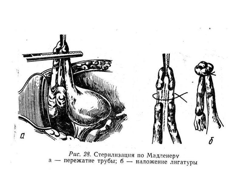 Анатомия малого таза презентация