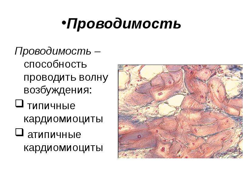 Атипичные кардиомиоциты рисунок