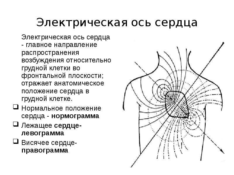 Оси сердца рисунок