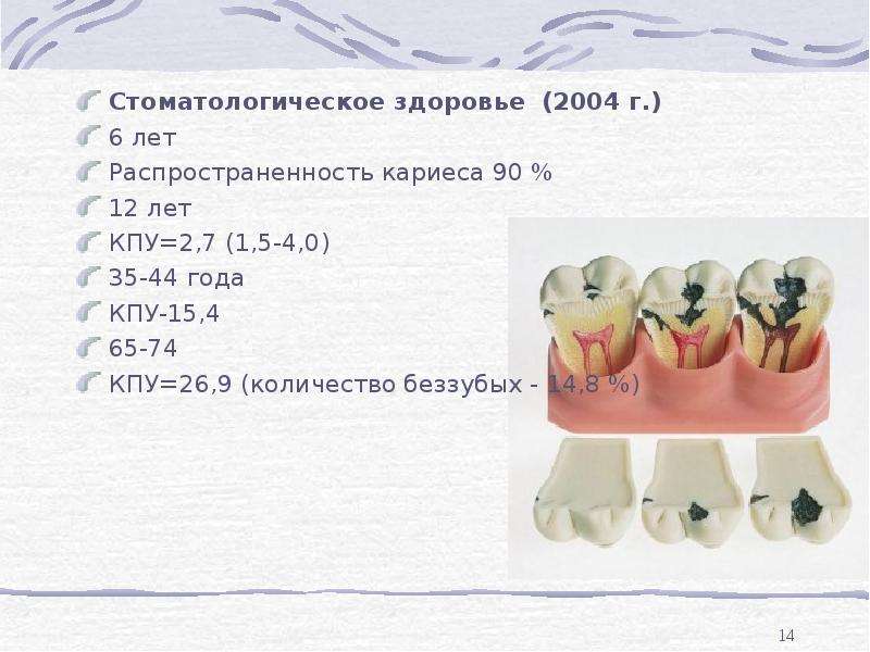 Ребенка кариес коренных зубах. Классификация кариеса по глубине поражения.