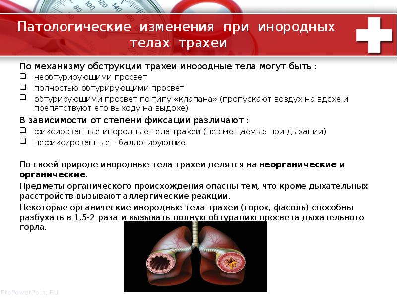 Презентация инородные тела жкт