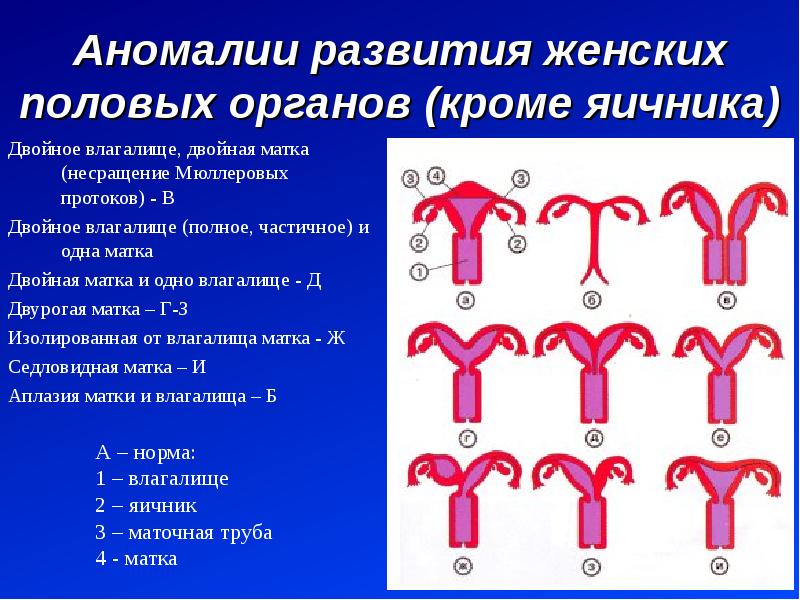 Строение женского организма картинки