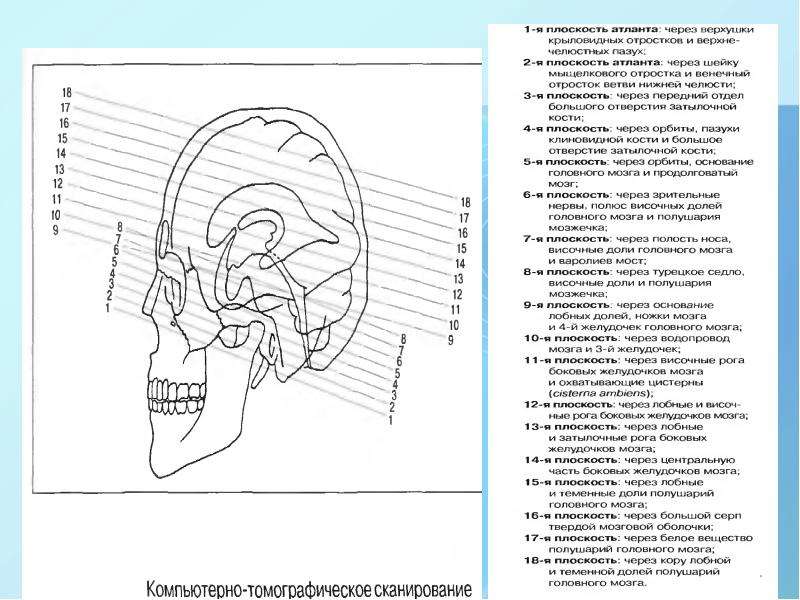 Отделы головы анатомия. Операции на мозговом отделе черепа. Клиническая анатомия мозгового отдела головы. Операции в области мозгового отдела головы.