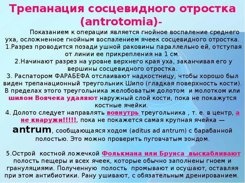 Трепанация треугольника шипо. Трепанация сосцевидногототростка. Трепанация сосцевидного отростка. Трепанация сосцпвидного отросток. Принципы трепанации сосцевидного отростка.