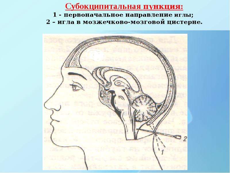 Анатомия мозгового отдела головы