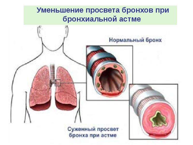 Первая помощь при неотложных ситуациях презентация