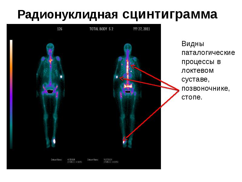 Радионуклидная диагностика фото