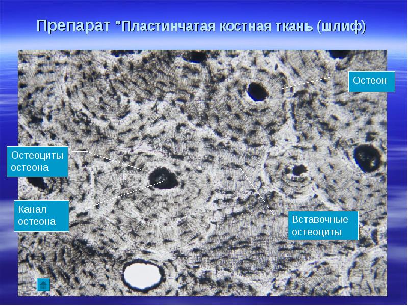 Ткань препарат. Пластинчатая костная ткань микроскоп. Пластинчатая костная ткань препарат гистология. Пластинчатая ткань гистология. Пластинчатая компактная костная ткань гистология.