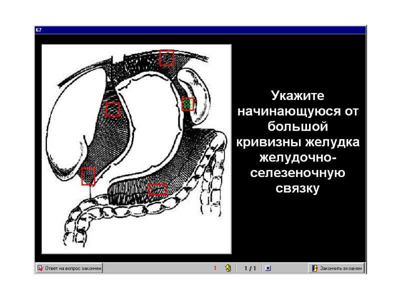 Большая кривизна желудка. Связки от большой кривизны желудка. Связки, берущие начало от большой кривизны желудка. От большой кривизны желудка начинаются связки.