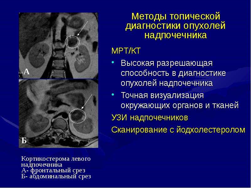 Болезни эндокринной системы презентация