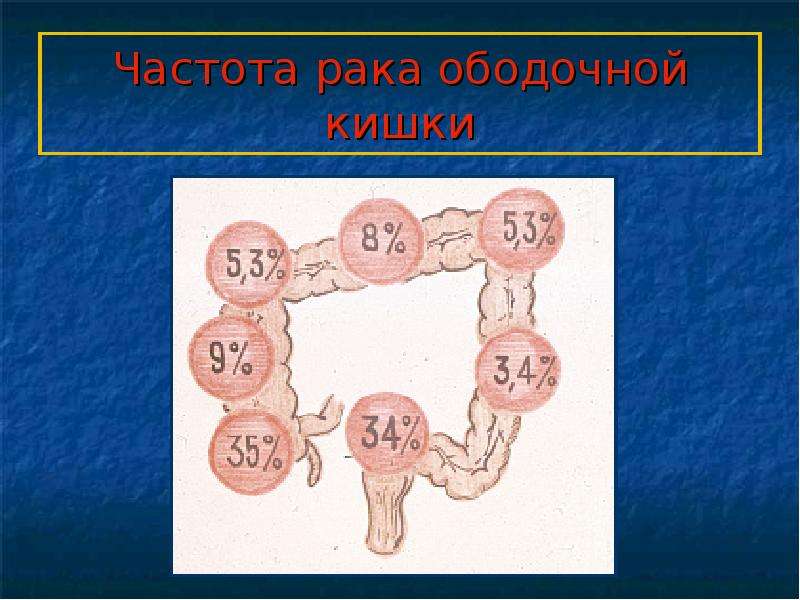 Презентация по кишечной непроходимости