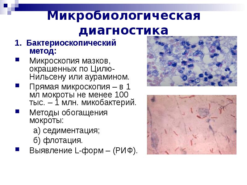 Микобактерии методы микроскопии