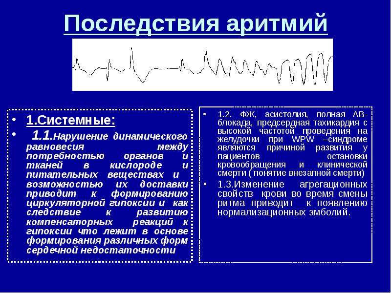 Нарушение сердечного ритма презентация