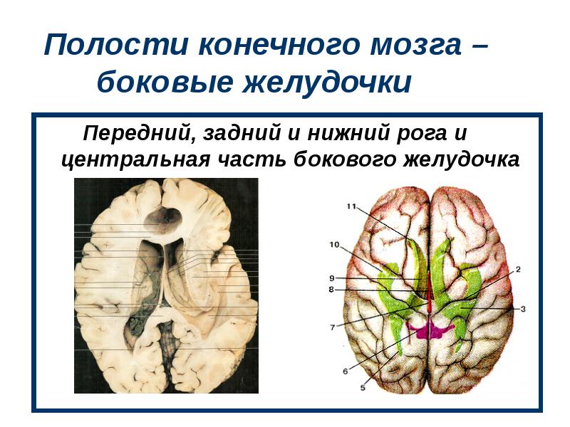 Полости мозга заполнены. Боковые желудочки головного мозга анатомия. Отделы боковых желудочков конечного мозга. Нижний Рог бокового желудочка. Конечный мозг желудочки мозга.
