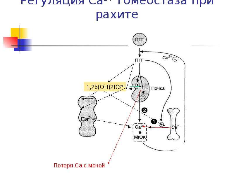 Механизм развития рахита схема