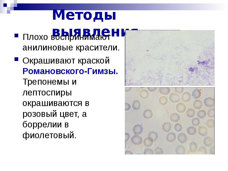 Элементарные тельца хламидий по романовскому гимзе окрашиваются