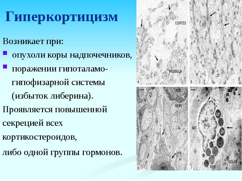 Гормонально активные опухоли надпочечников