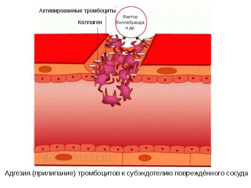 Адгезия (прилипание) тромбоцитов к субэндотелию повреждённого сосуда