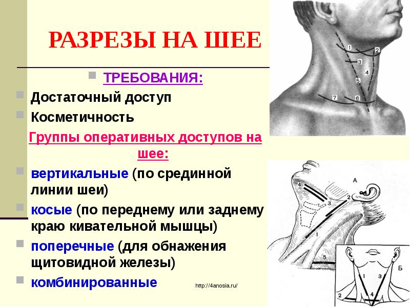 Сосудистый шов топографическая анатомия презентация