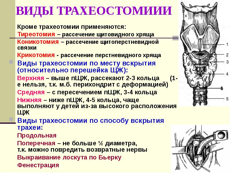 Загрудинная трахеостомия. Нижняя трахеостомия топографическая анатомия. Средняя трахеостомия техника. Этапы трахеостомии топографическая анатомия.