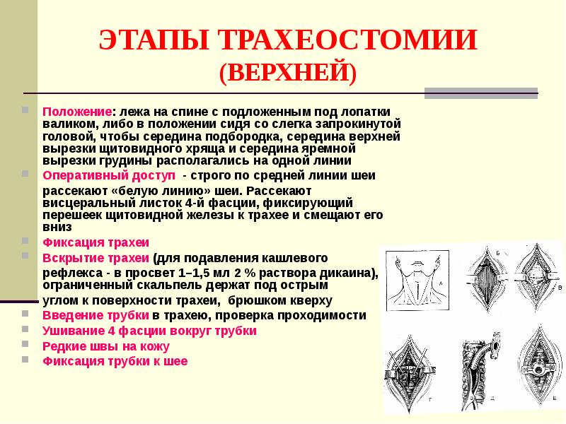 Операции на шее презентация