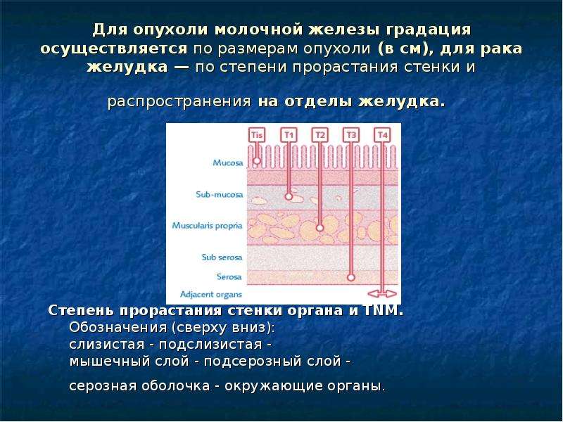 Рост опухоли в стенку полого органа называется