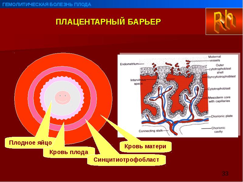 Гемолитическая болезнь