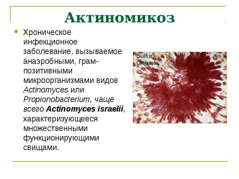 Острая аэробная хирургическая инфекция презентация