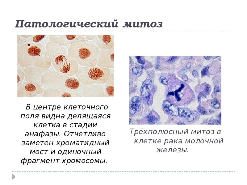 Патологический митоз рисунок