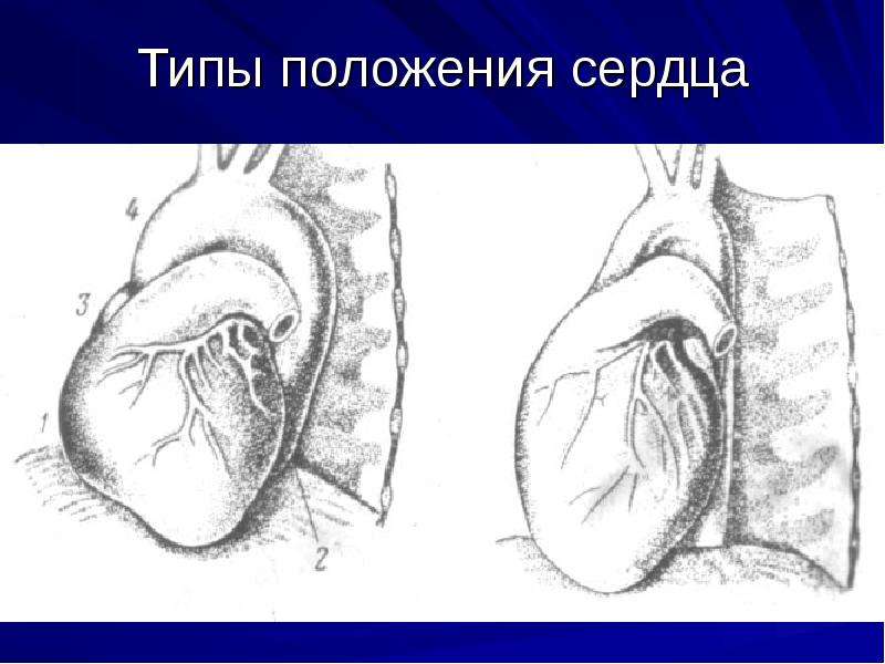 При смене положения сердце. Типы положения сердца.