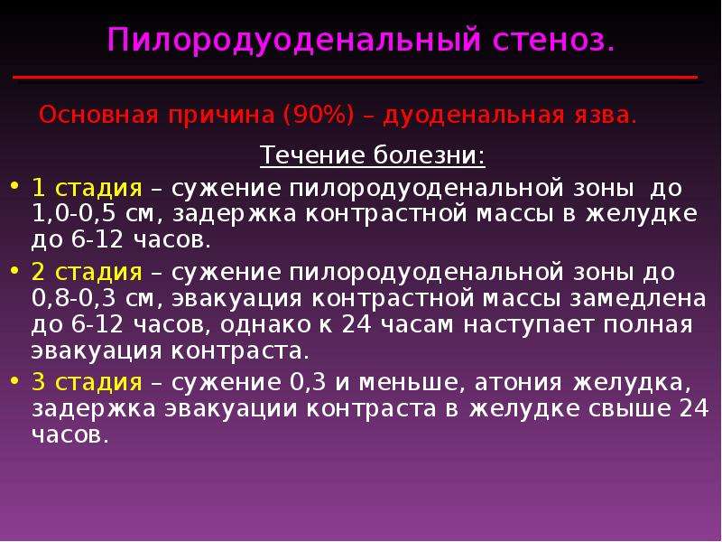 90 причин. Пальпация пилородуоденальной зоны. Осложнения пилородуоденального стеноза. Язва пилородуоденальной зоны. Ужение пилородуоде-нальной зоны.