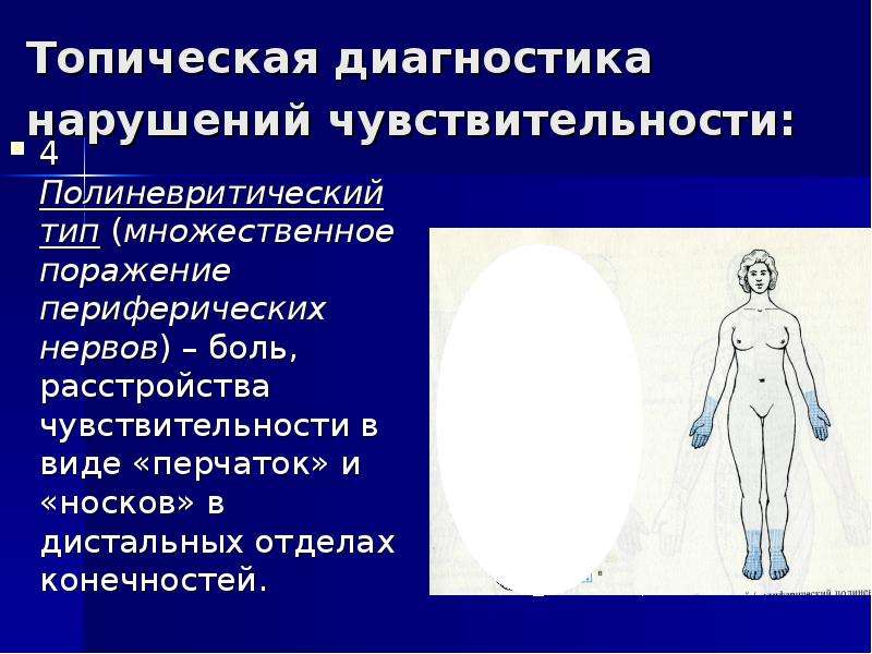 Болевое нарушение чувствительности. Полиневритический Тип нарушения чувствительности неврология. Топическая диагностика нарушений чувствительности. Дистальный полиневритический Тип расстройства чувствительности. Периферический полиневритический Тип нарушения чувствительности.