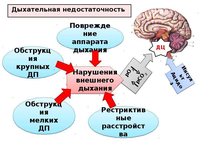 Острая дыхательная недостаточность клиническая картина