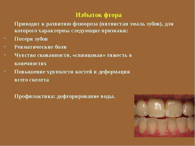 Для профилактики недостаточности фтора среди населения возможно