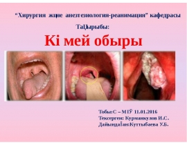Көмей обыры