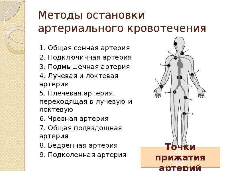 Виды кровотечений способы остановки кровотечений презентация